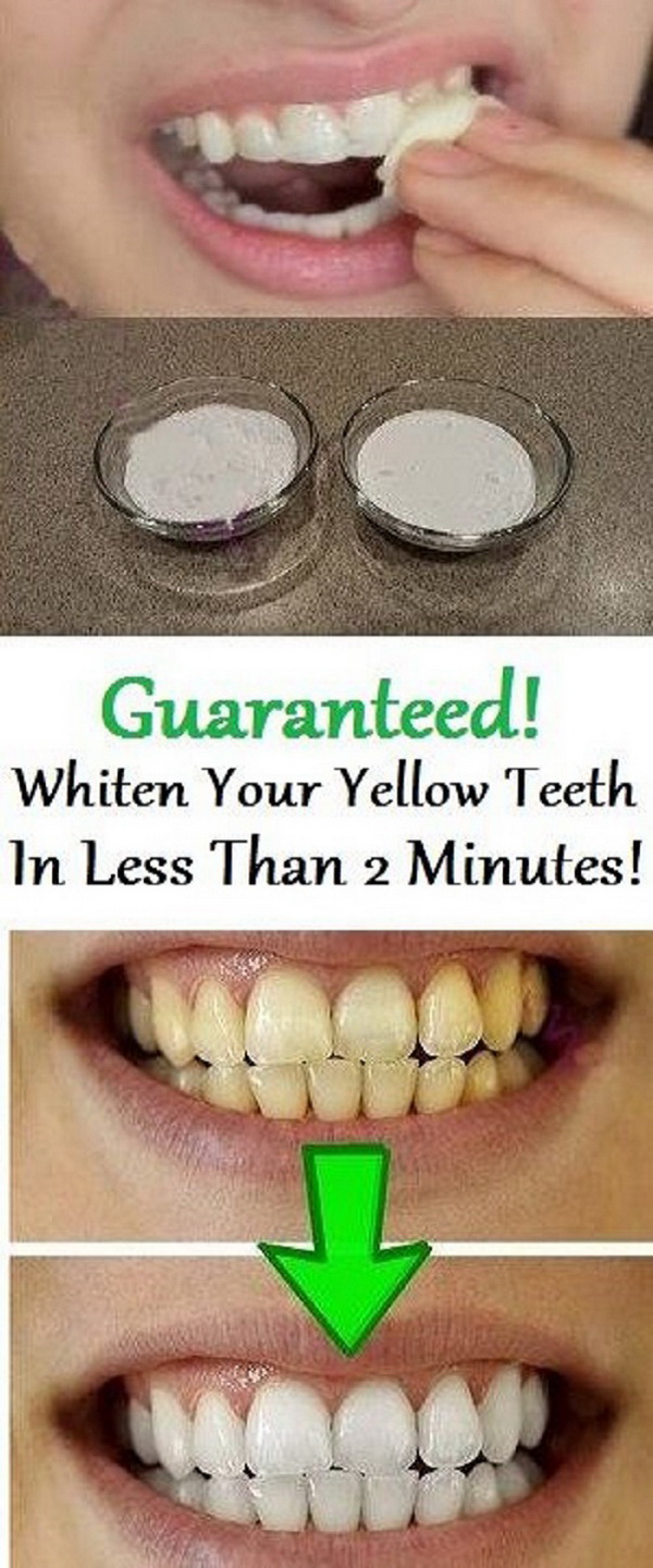 Whiten Your Teeth with Baking Soda and Lemon Juice Paste. 