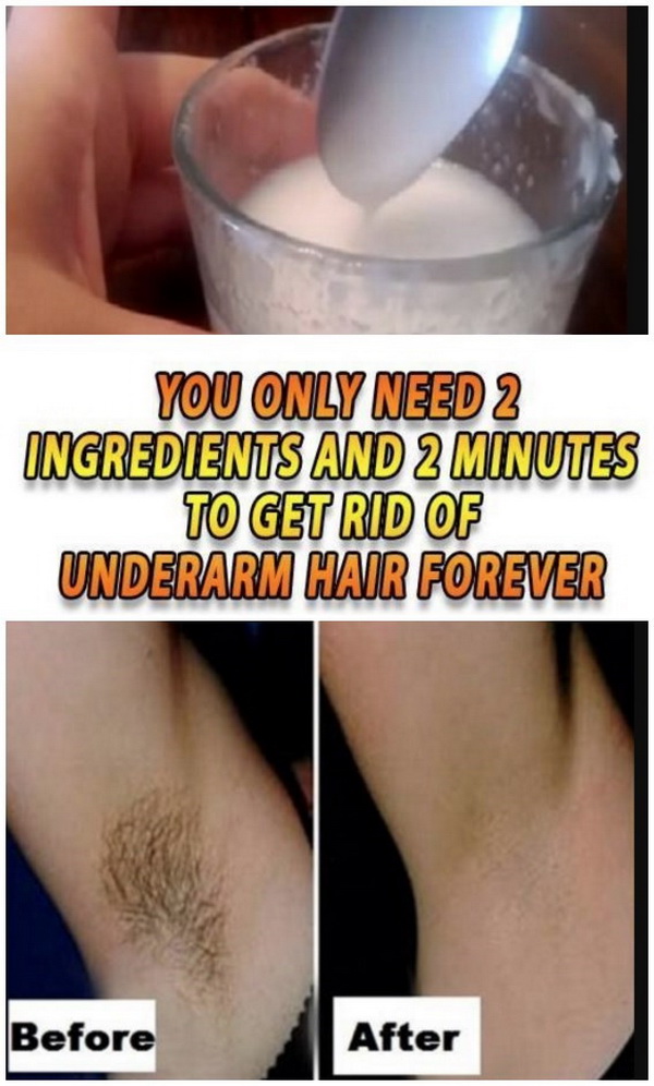 Homemade 2 Ingredients To Get Rid of Underarm Hair Forever. 