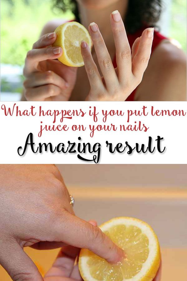Treat Yellow Nails Safely with Lemon. 